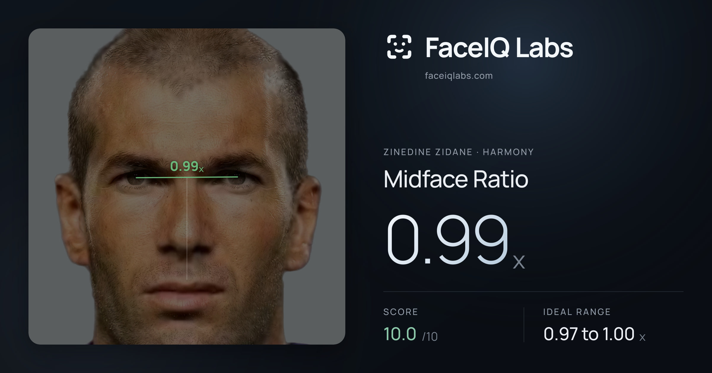Zinedine Zidane Midface Ratio: 0.99x, drawn on the photo