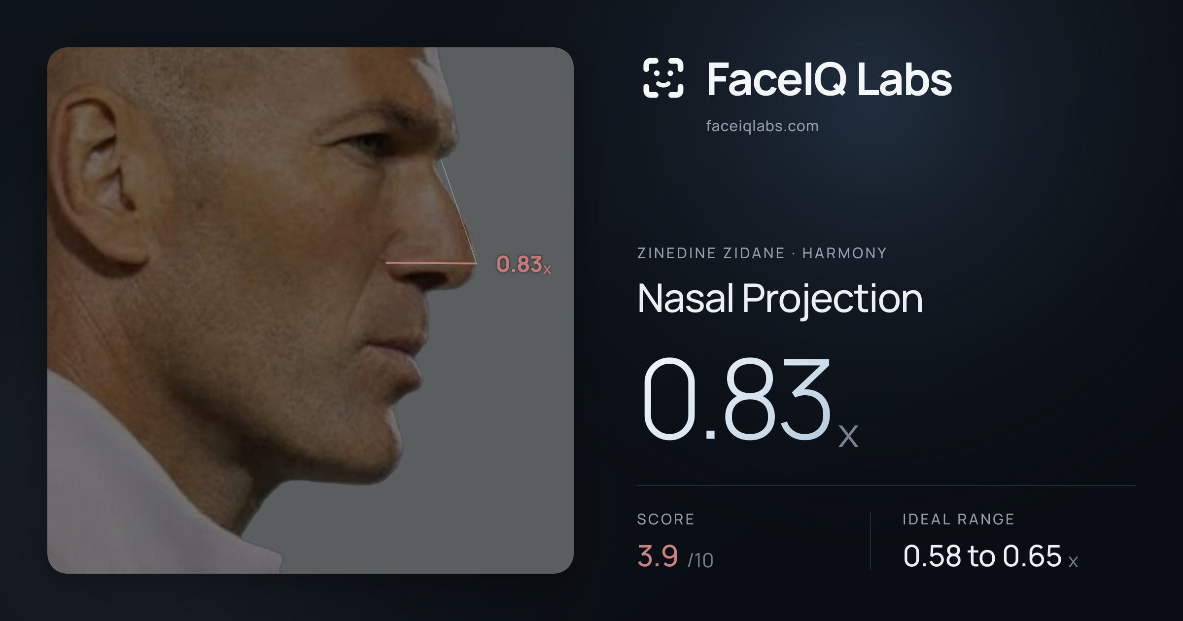 Zinedine Zidane Nasal Projection: 0.83x, drawn on the photo