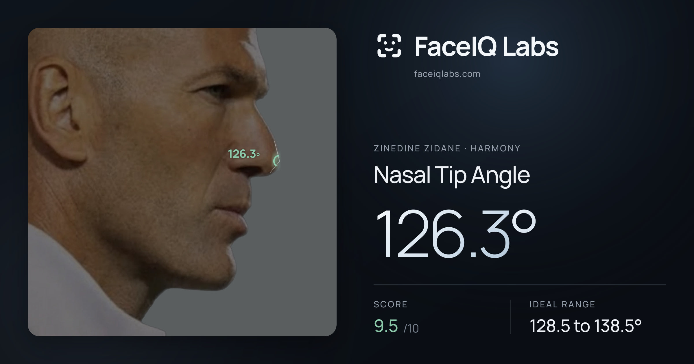 Zinedine Zidane Nasal Tip Angle: 126.3°, drawn on the photo