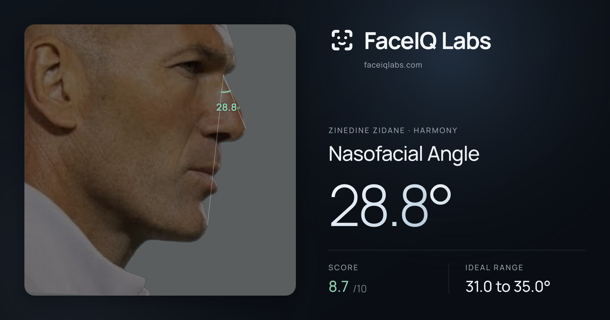 Zinedine Zidane Nasofacial Angle: 28.8°, drawn on the photo