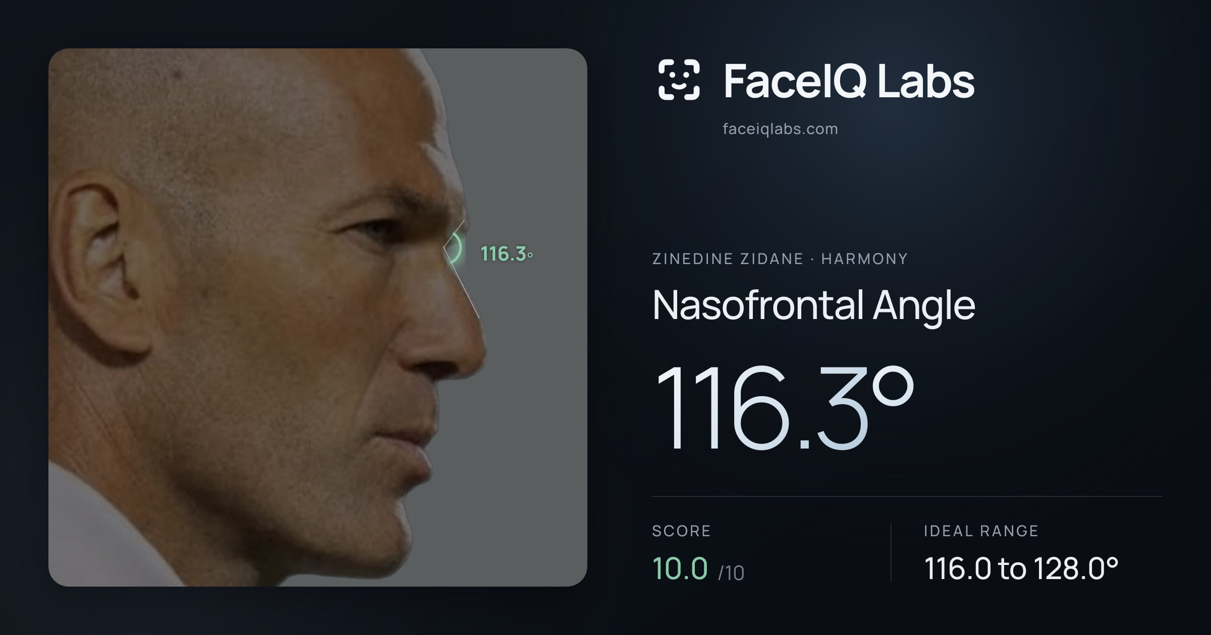 Zinedine Zidane Nasofrontal Angle: 116.3°, drawn on the photo