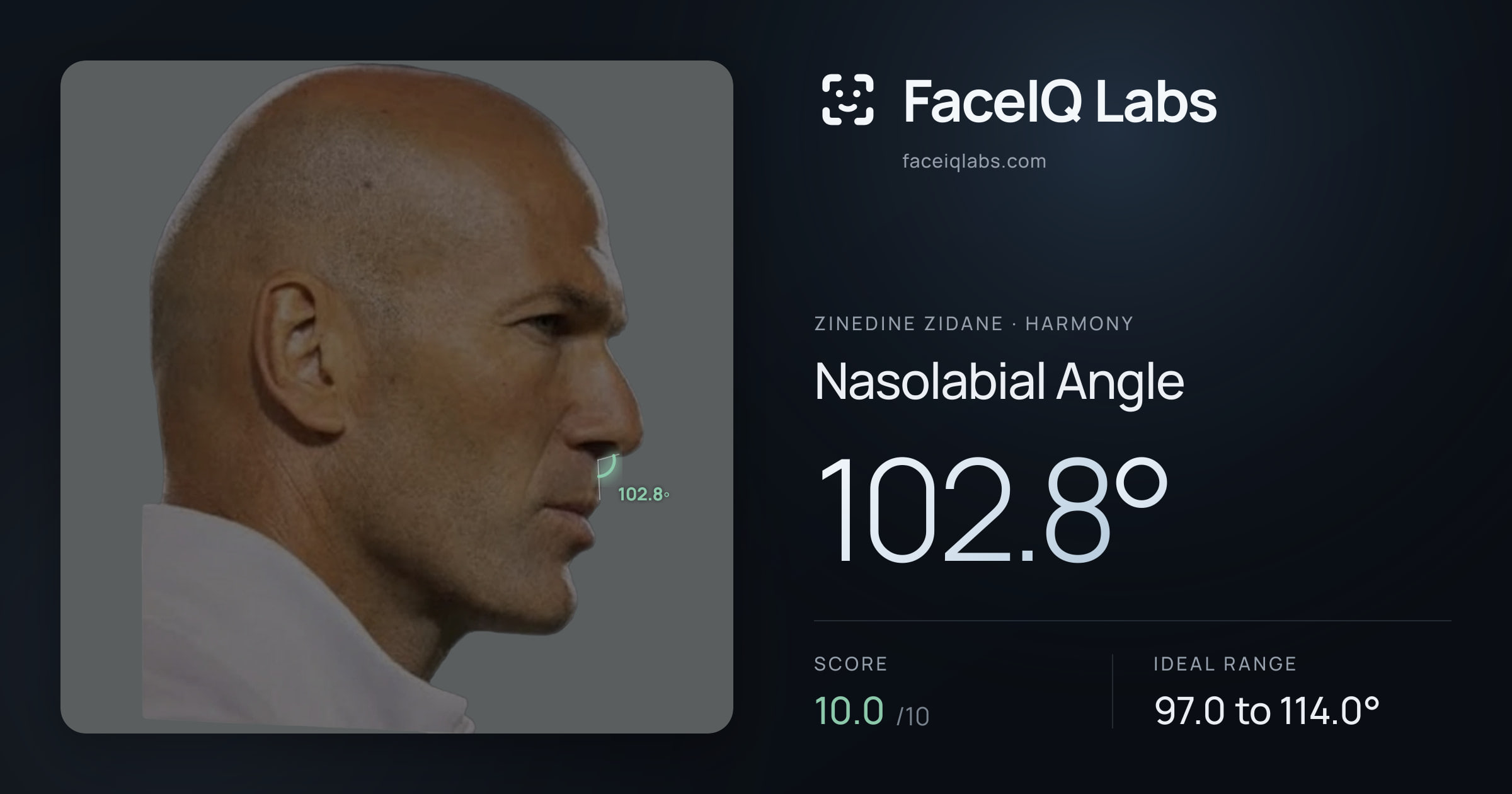 Zinedine Zidane Nasolabial Angle: 102.8°, drawn on the photo