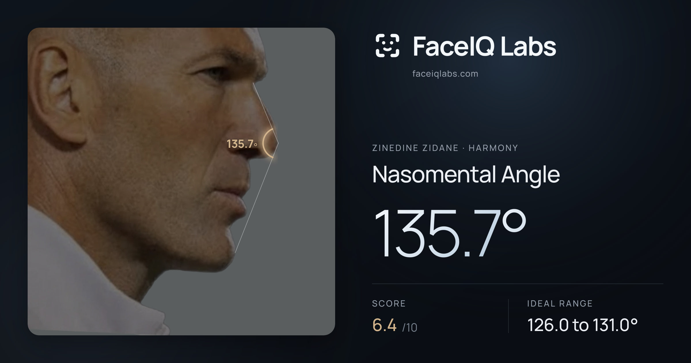 Zinedine Zidane Nasomental Angle: 135.7°, drawn on the photo