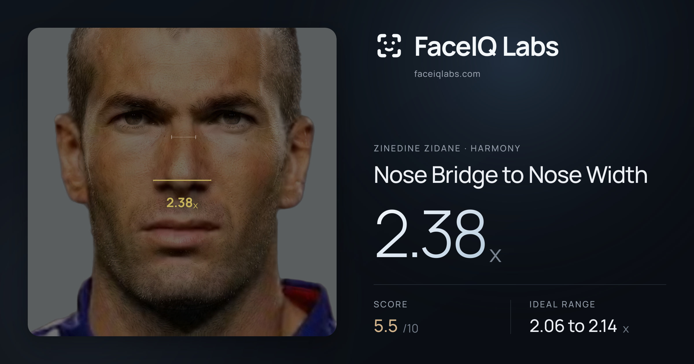 Zinedine Zidane Nose Bridge to Nose Width: 2.38x, drawn on the photo
