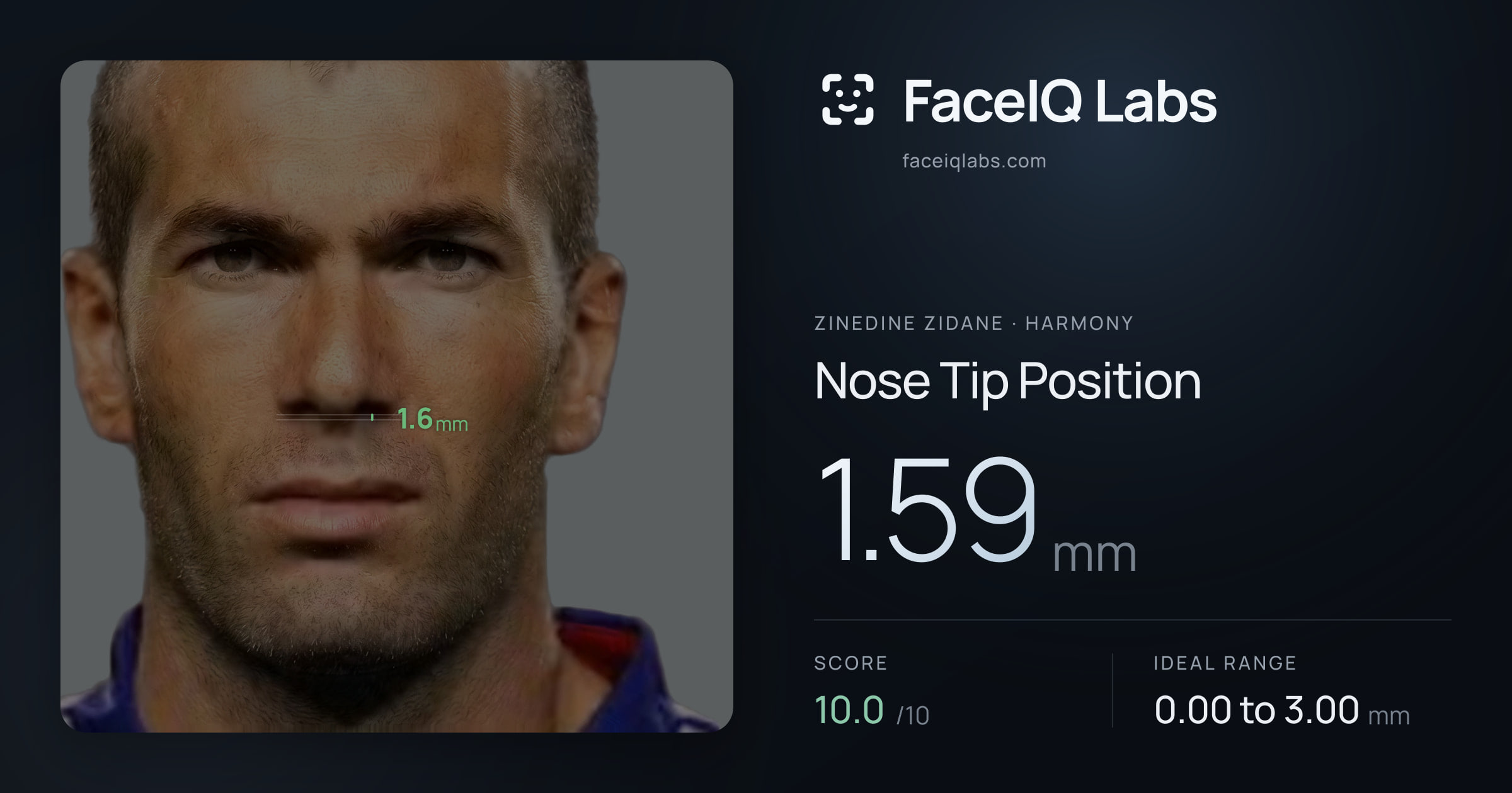 Zinedine Zidane Nose Tip Position: 1.59mm, drawn on the photo