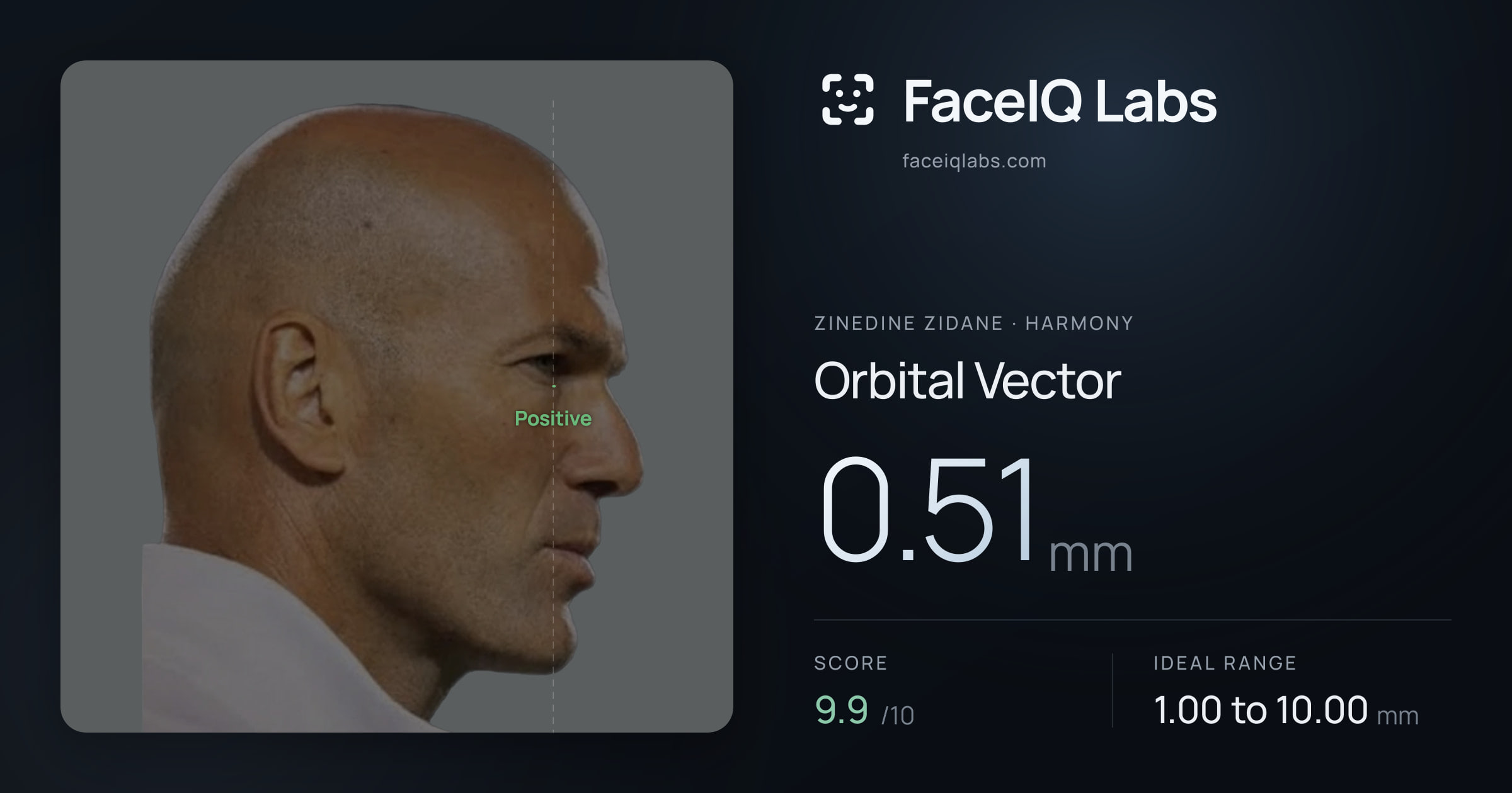 Zinedine Zidane Orbital Vector: 0.51mm, drawn on the photo