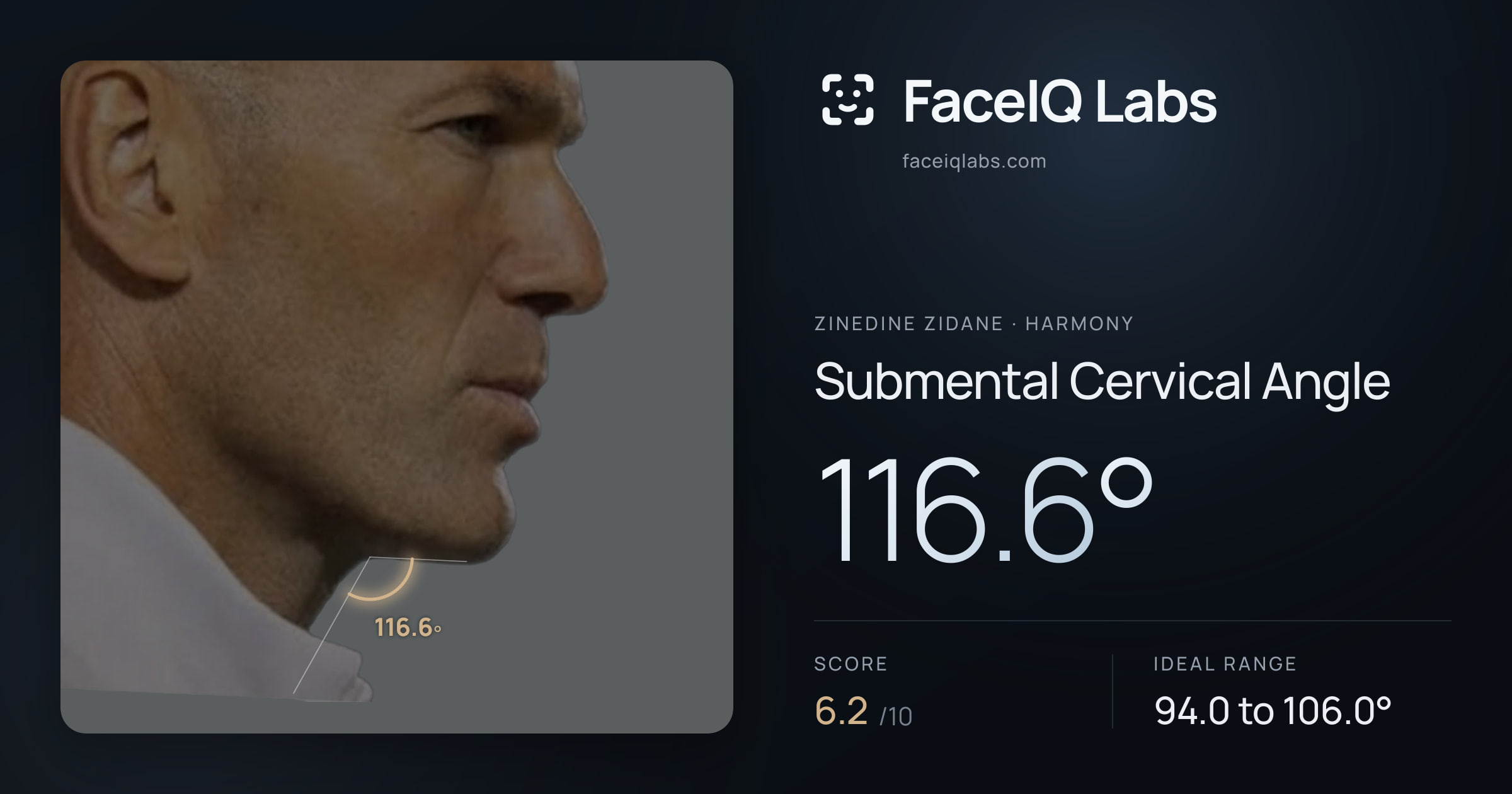 Zinedine Zidane Submental Cervical Angle: 116.6°, drawn on the photo