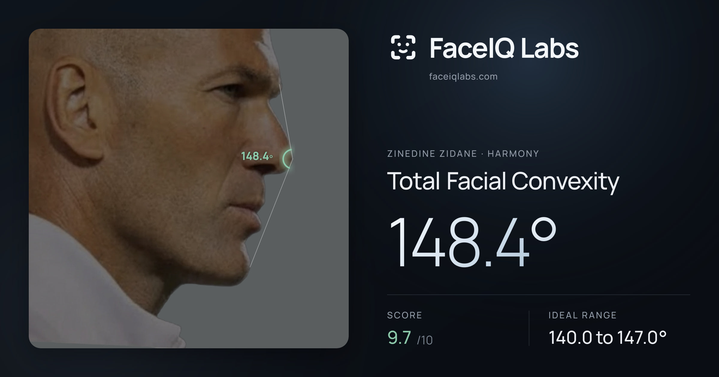 Zinedine Zidane Total Facial Convexity: 148.4°, drawn on the photo