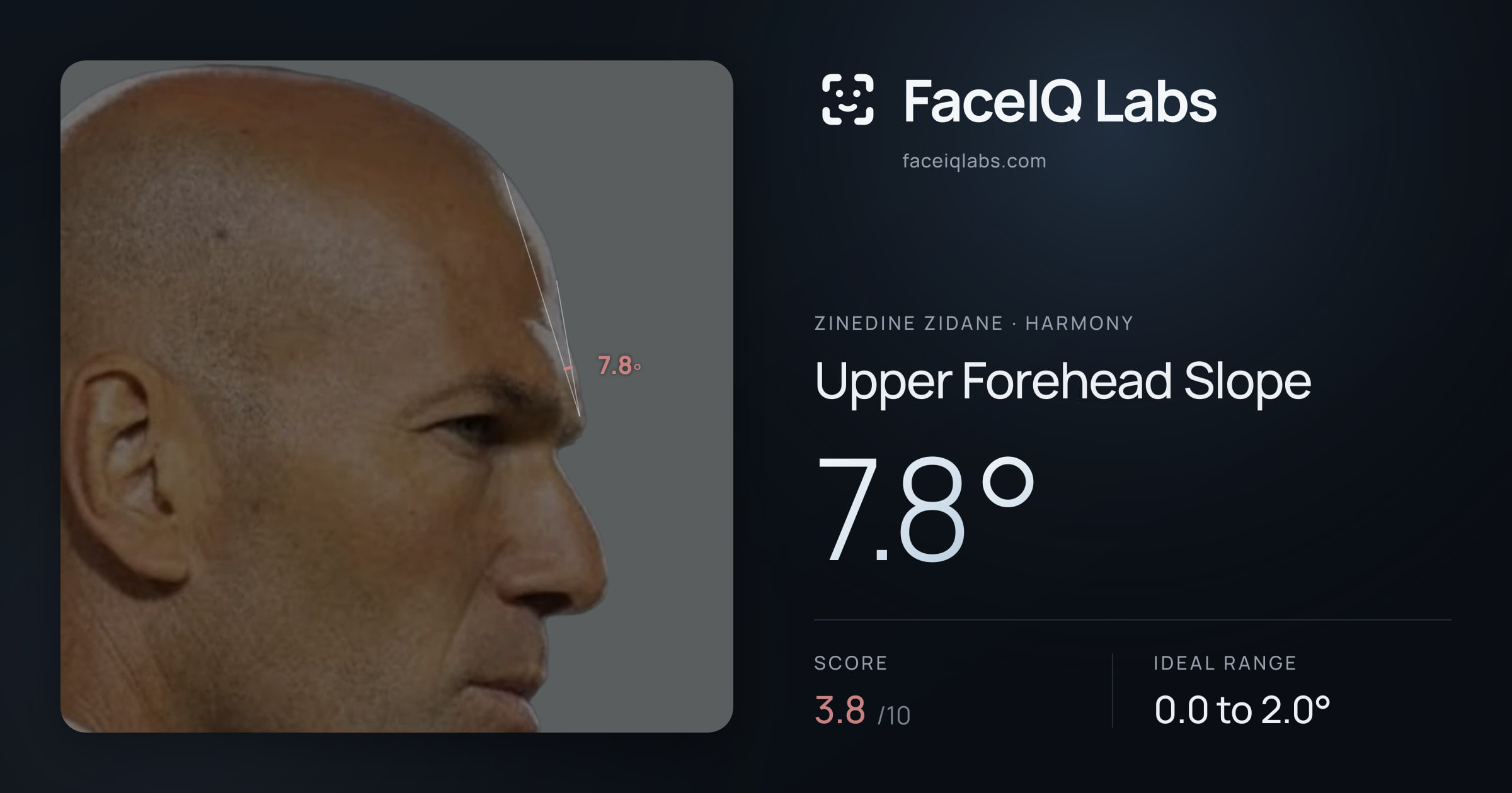 Zinedine Zidane Upper Forehead Slope: 7.8°, drawn on the photo
