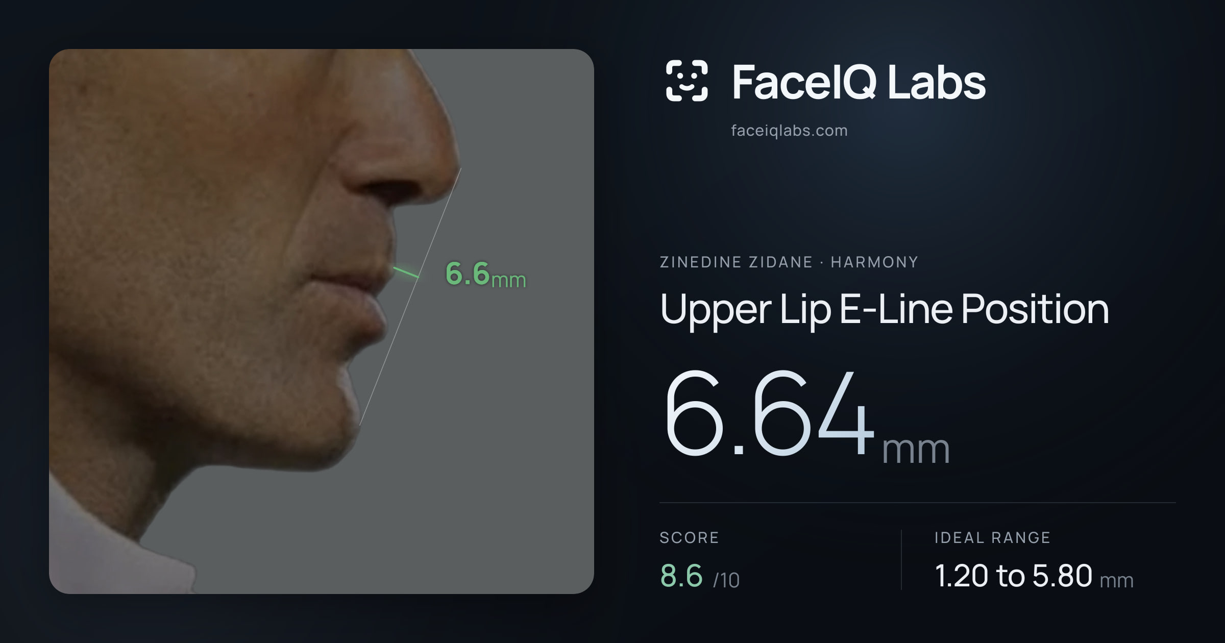 Zinedine Zidane Upper Lip E-Line Position: 6.64mm, drawn on the photo