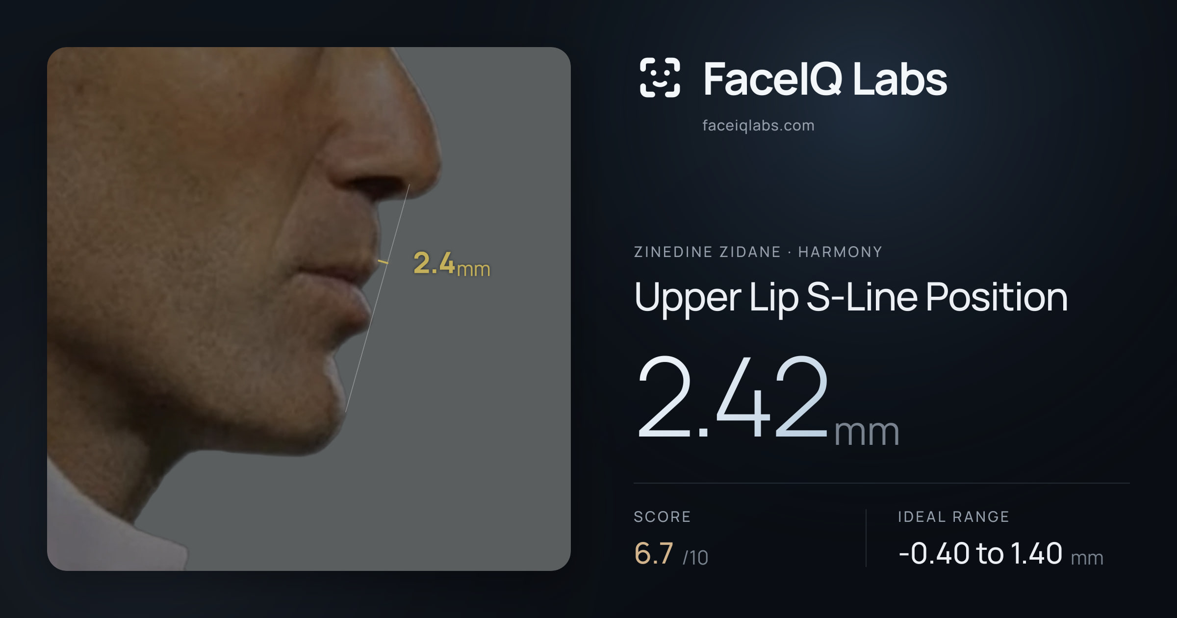 Zinedine Zidane Upper Lip S-Line Position: 2.42mm, drawn on the photo