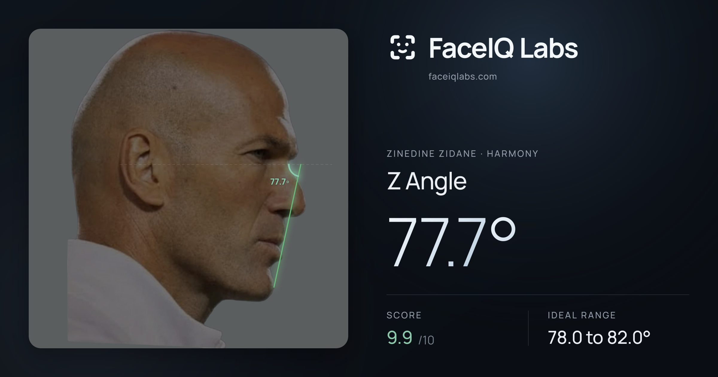 Zinedine Zidane Z Angle: 77.7°, drawn on the photo